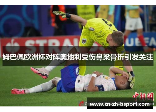 姆巴佩欧洲杯对阵奥地利受伤鼻梁骨折引发关注 姆巴佩欧洲杯对阵奥地利受伤鼻梁骨折引发关注